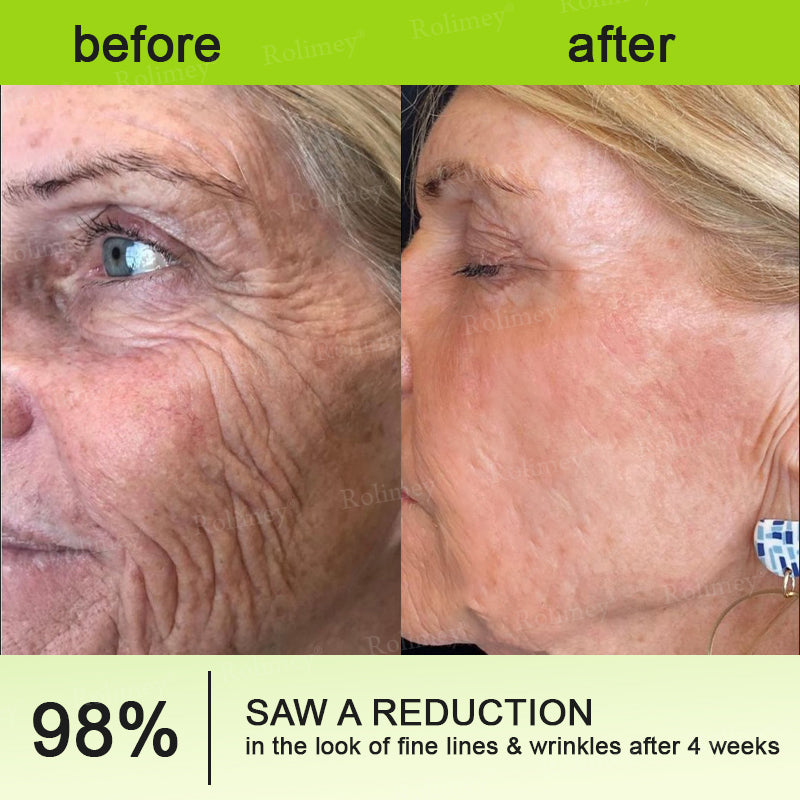 ✨Final 3 day 70% of !🌿QIAWI™ Firming & Vita-A Retinol Cream
