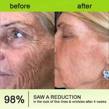 ✨Final 3 day 70% of !🌿QIAWI™ Firming & Vita-A Retinol Cream