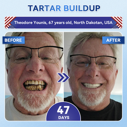 Alisanda® 🦷 Tideglusib Fast‑Dissolving Tooth & Gum Repair Oral Strips ✨